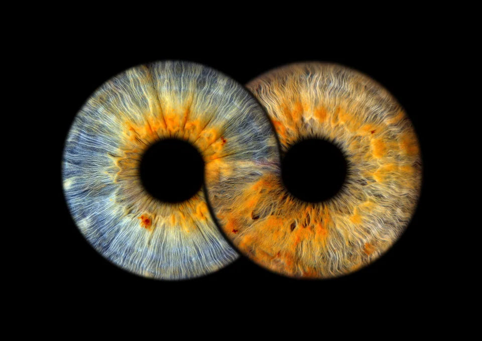 Infinity – zwei individuelle Iriden als gemeinsame Collage; Motivbeispiel.